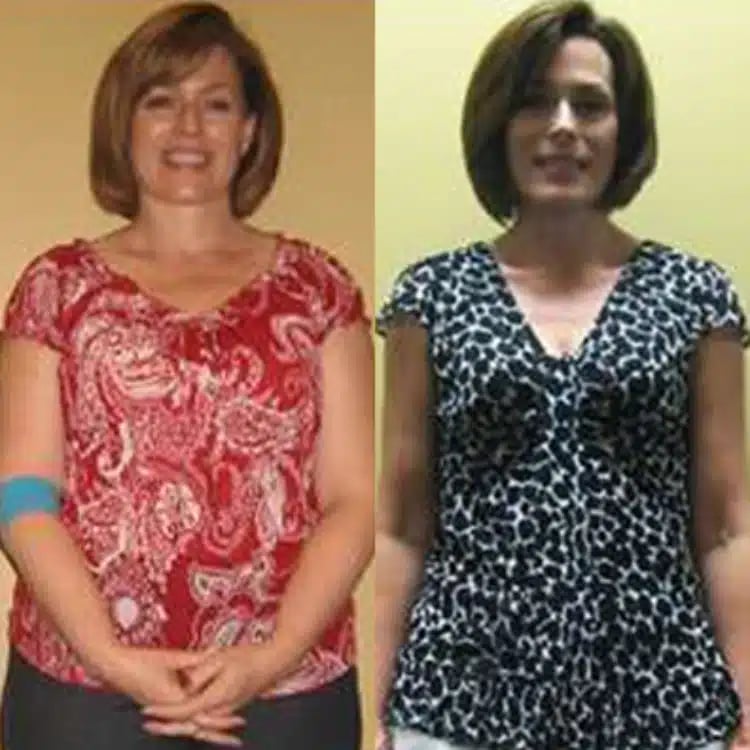 debbi weight loss before and after scottsdale weight loss center