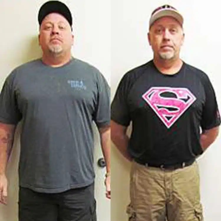 dennis l weight loss before and after scottsdale weight loss center