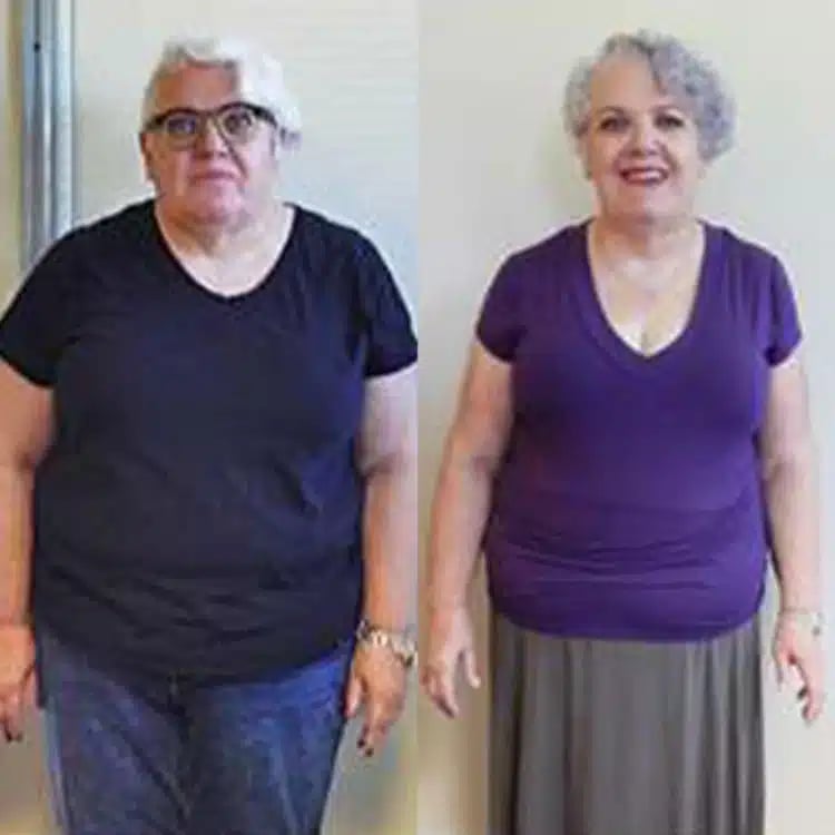 mary c weight loss before and after scottsdale weight loss center