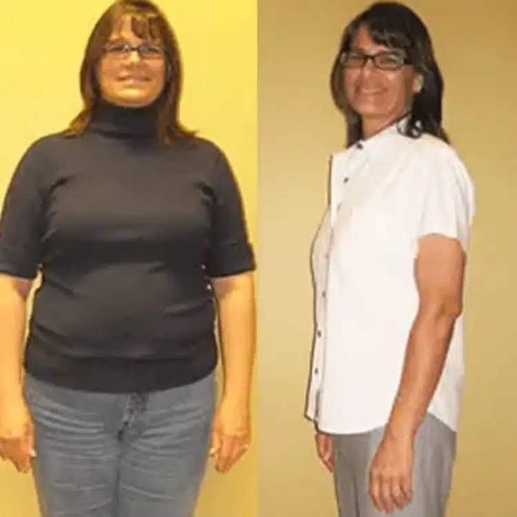 marianne weight loss before and after scottsdale weight loss center