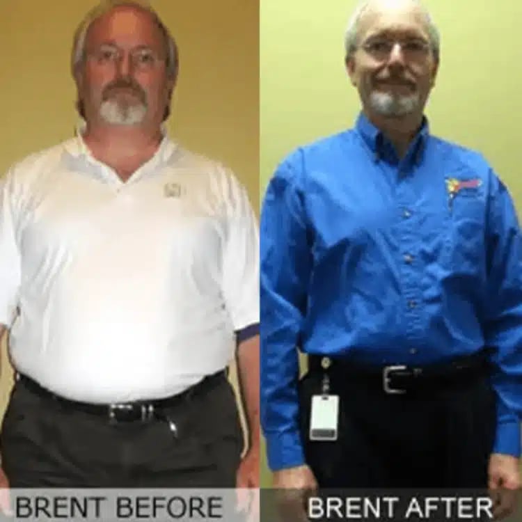 brent weight loss before and after scottsdale weight loss center