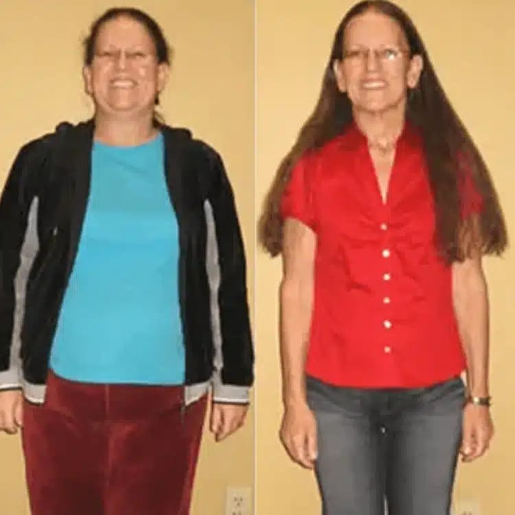 connie weight loss before and after scottsdale weight loss center