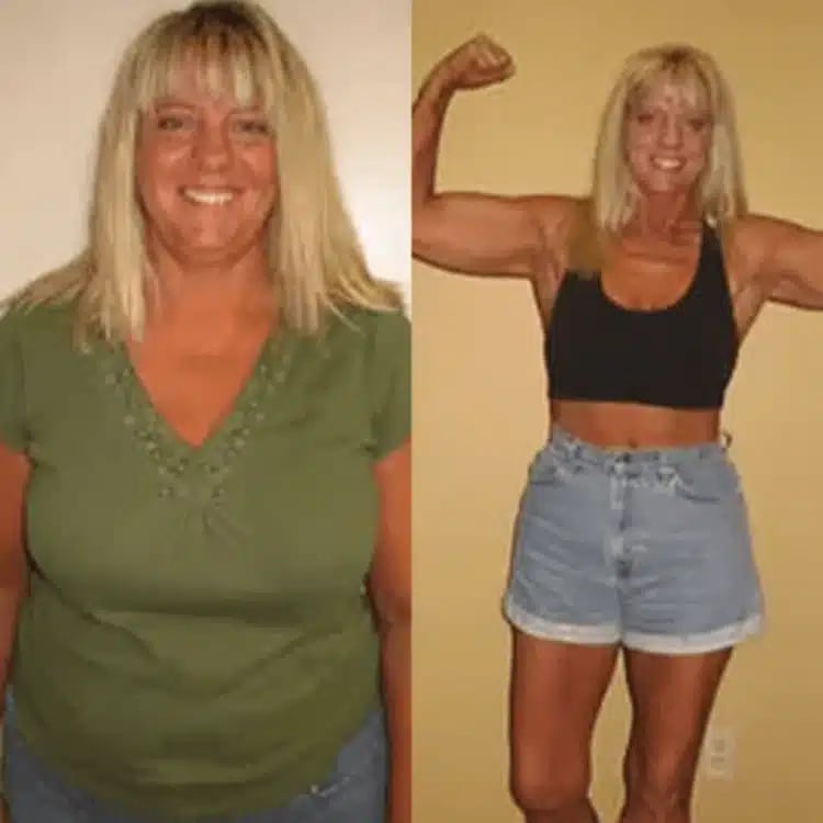 beverly weight loss before and after scottsdale weight loss center