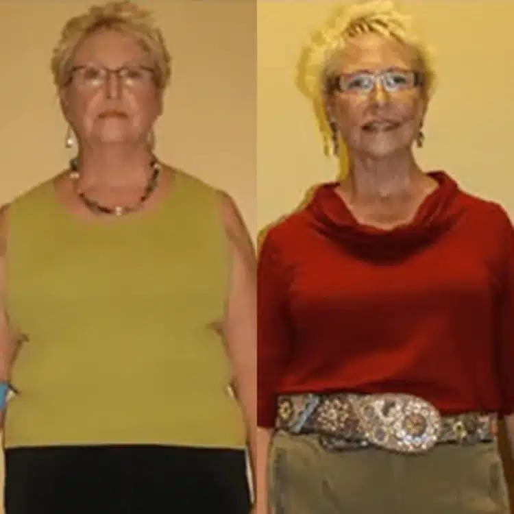 marge weight loss before and after scottsdale weight loss center