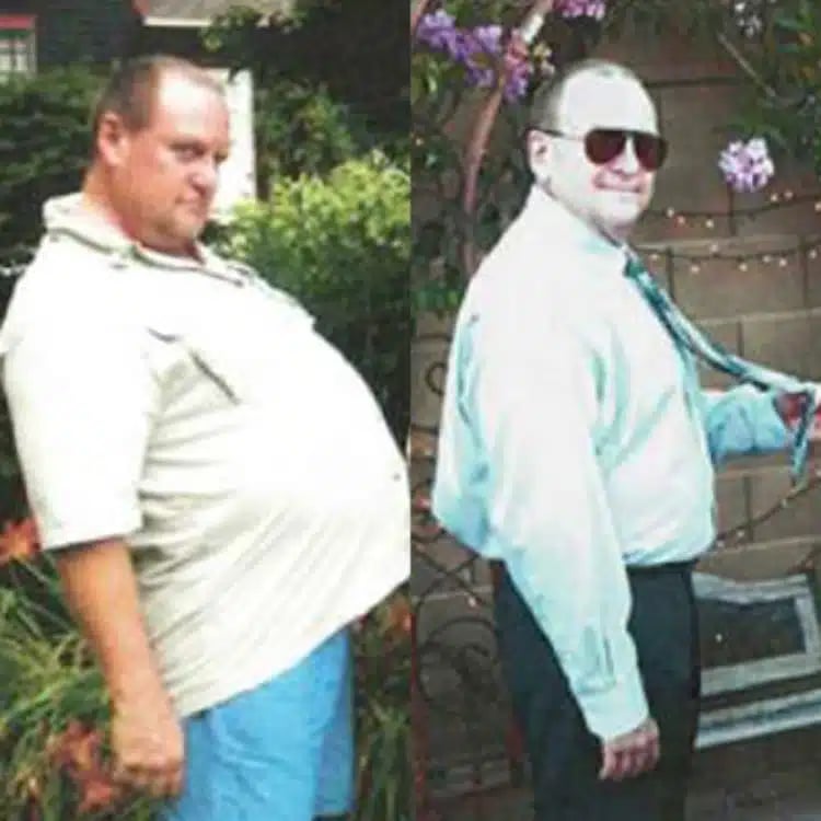 mark weight loss before and after scottsdale weight loss center