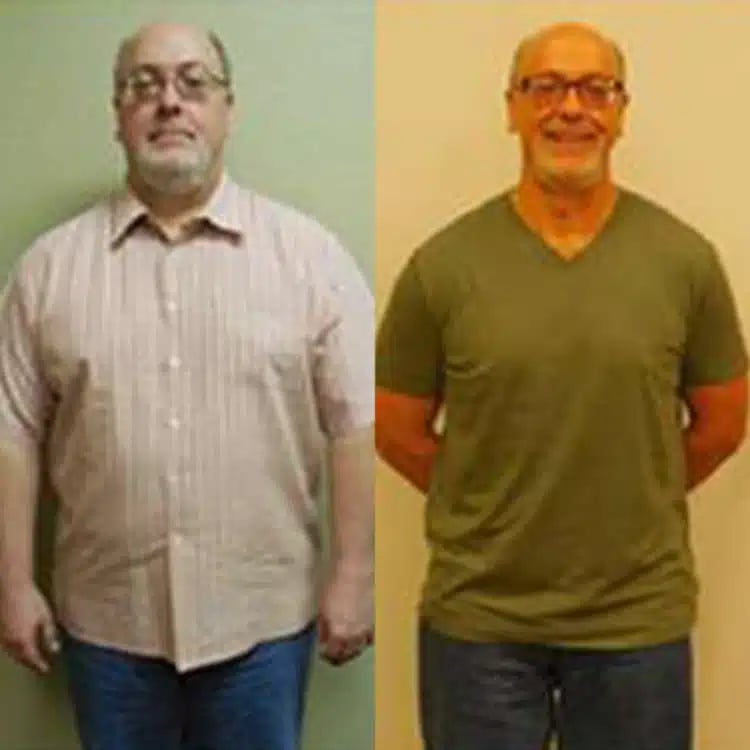 kirk weight loss before and after scottsdale weight loss center