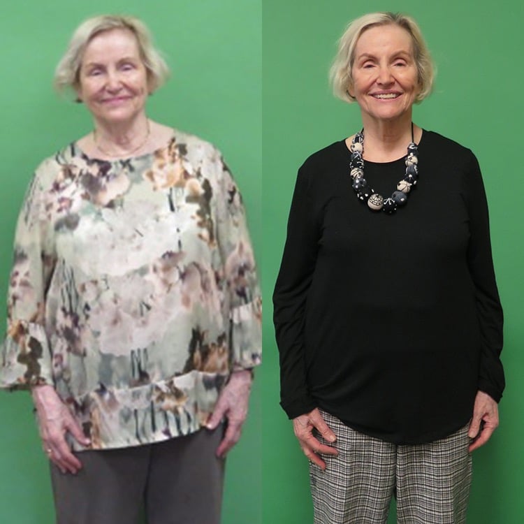 merle weight loss before and after scottsdale weight loss center