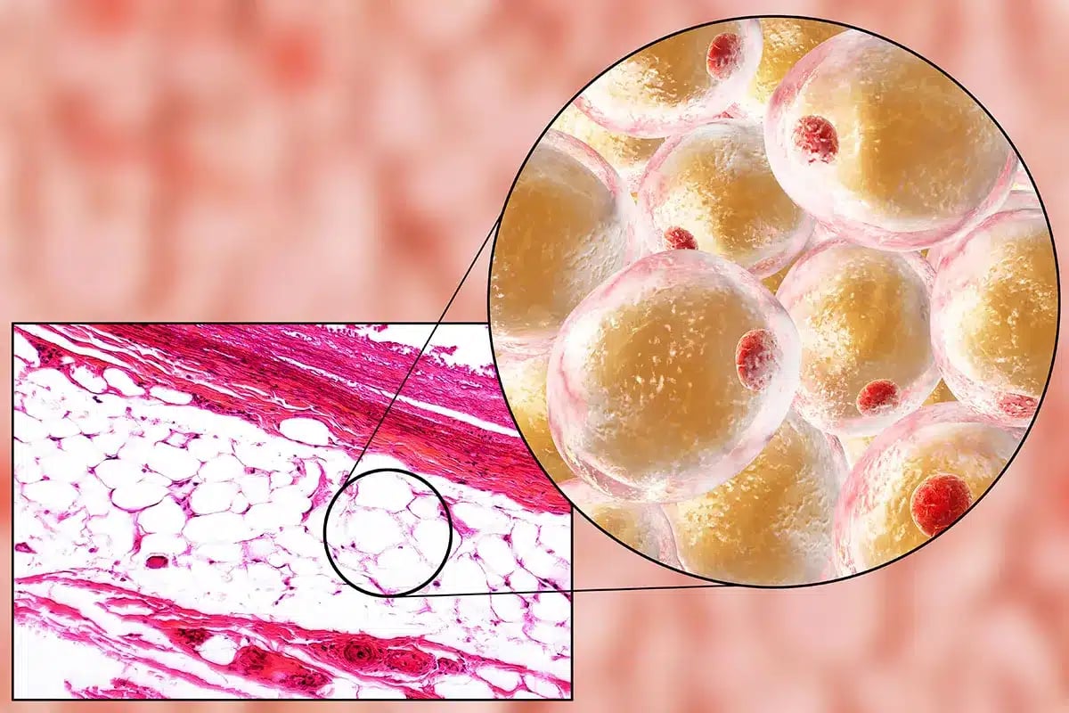 Microscopic view of fat cells.