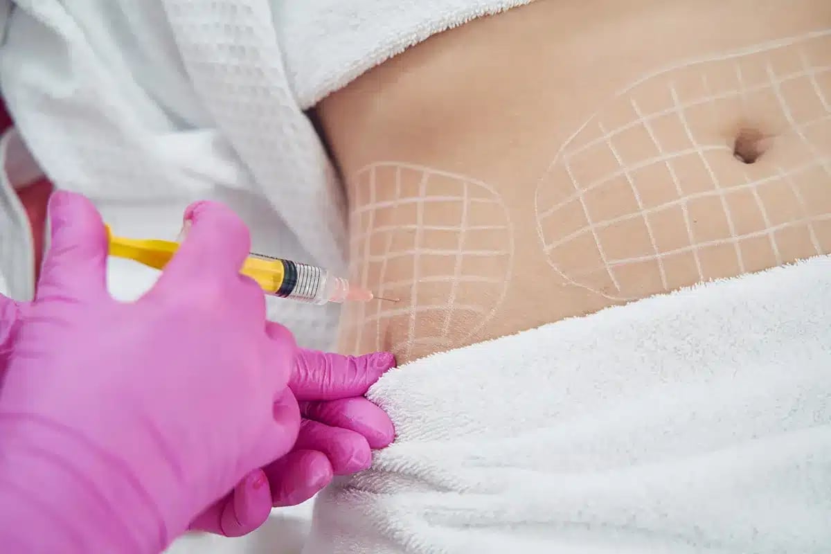 fat dissolving injection