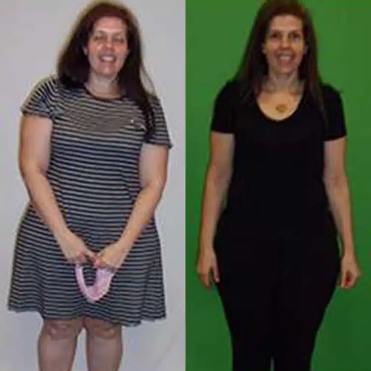 nicole w weight loss before and after scottsdale weight loss center nicole w weight loss before and after scottsdale weight loss center