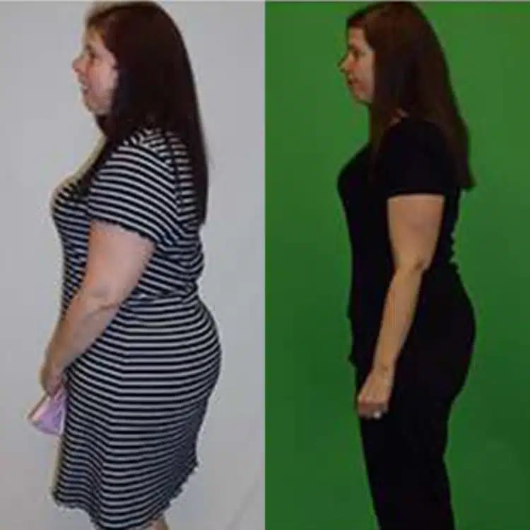 nicole w weight loss before and after scottsdale weight loss center nicole w weight loss before and after scottsdale weight loss center